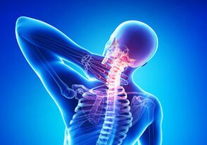 Sinais de osteocondrose cervical
