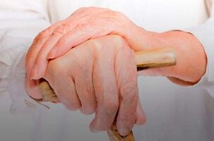 dor nas articulações dos dedos com artrite reumatóide