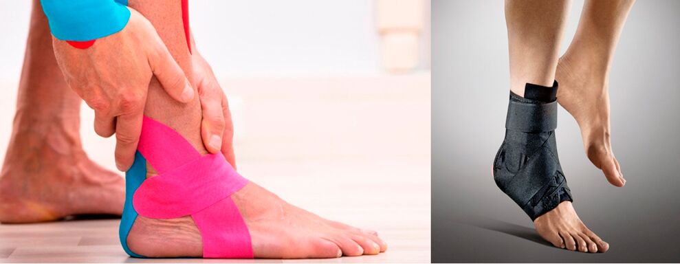 Órtese e bandagem da articulação do tornozelo em caso de artrose