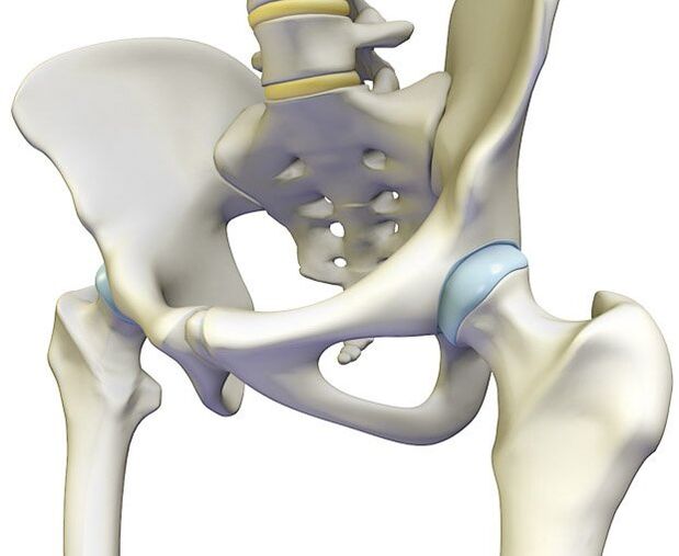A osteocondrose provoca uma dor aguda na articulação do quadril